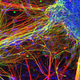 Illustration for article titled This is what schizophrenia looks like at the molecular level
